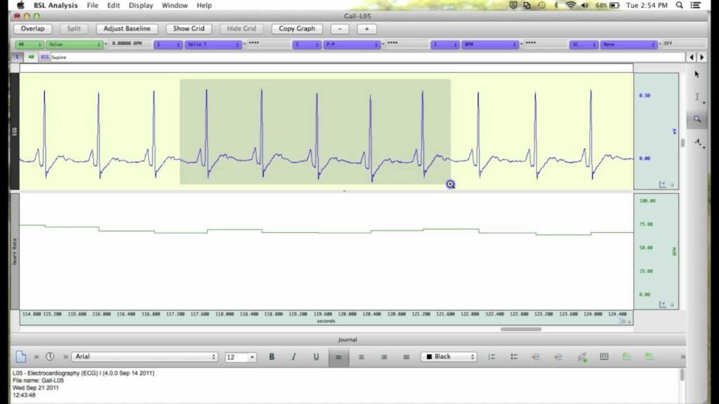 How to Sign Data Analysis in BSL