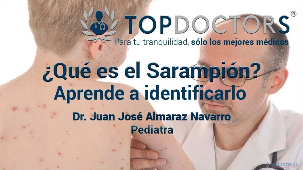 Cómo signar Sarampión en LSE